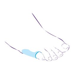 Протектор силиконовый для защиты сустава пятого пальца стопы СТ-48  Trives